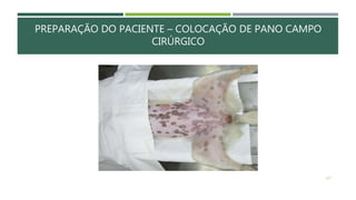 PREPARAÇÃO DO PACIENTE – COLOCAÇÃO DE PANO CAMPO
CIRÚRGICO
127
 