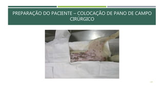 PREPARAÇÃO DO PACIENTE – COLOCAÇÃO DE PANO DE CAMPO
CIRÚRGICO
128
 