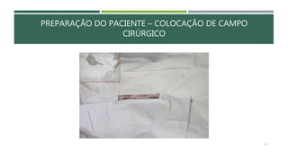PREPARAÇÃO DO PACIENTE – COLOCAÇÃO DE CAMPO
CIRÚRGICO
130
 