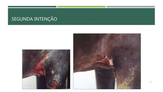 SEGUNDA INTENÇÃO
138
 