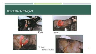 TERCEIRA INTENÇÃO
139
12º dia - sutura
3 dias
12 dias
1º dia
 