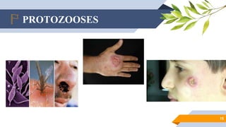 PROTOZOOSES
15
 