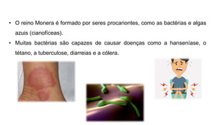 • O reino Monera é formado por seres procariontes, como as bactérias e algas
azuis (cianofíceas).
• Muitas bactérias são capazes de causar doenças como a hanseníase, o
tétano, a tuberculose, diarreias e a cólera.
 