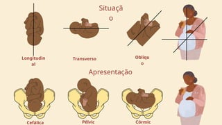 Longitudin
al
Transverso Oblíqu
o
Situaçã
o
Cefálica Pélvic Córmic
Apresentação
 
