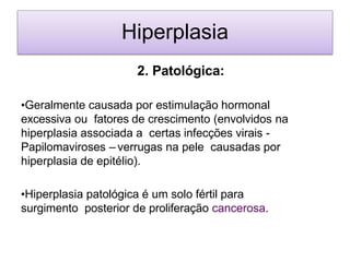 Hiperplasia
2. Patológica:
•Geralmente causada por estimulação hormonal
excessiva ou fatores de crescimento (envolvidos na
hiperplasia associada a certas infecções virais -
Papilomaviroses – verrugas na pele causadas por
hiperplasia de epitélio).
•Hiperplasia patológica é um solo fértil para
surgimento posterior de proliferação cancerosa.
 