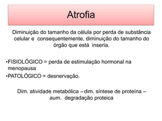 Atrofia
Diminuição do tamanho da célula por perda de substância
celular e consequentemente, diminuição do tamanho do
órgão que está inseria.
•FISIOLÓGICO = perda de estimulação hormonal na
menopausa
•PATOLÓGICO = desnervação.
Dim. atividade metabólica – dim. síntese de proteína –
aum. degradação proteica
 