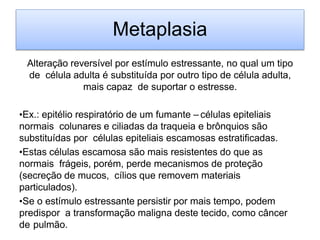 Metaplasia
Alteração reversível por estímulo estressante, no qual um tipo
de célula adulta é substituída por outro tipo de célula adulta,
mais capaz de suportar o estresse.
•Ex.: epitélio respiratório de um fumante – células epiteliais
normais colunares e ciliadas da traqueia e brônquios são
substituídas por células epiteliais escamosas estratificadas.
•Estas células escamosa são mais resistentes do que as
normais frágeis, porém, perde mecanismos de proteção
(secreção de mucos, cílios que removem materiais
particulados).
•Se o estímulo estressante persistir por mais tempo, podem
predispor a transformação maligna deste tecido, como câncer
de pulmão.
 