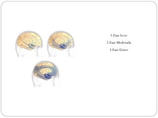1.Fase Leve
2.Fase Moderada
3.Fase Grave
 
