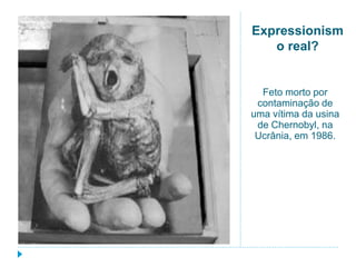 Expressionism
o real?
Feto morto por
contaminação de
uma vítima da usina
de Chernobyl, na
Ucrânia, em 1986.
 