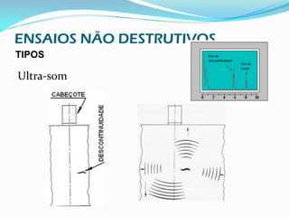 ENSAIOS NÃO DESTRUTIVOS
TIPOS

Ultra-som
 