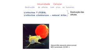 Imunidade Celular
Destruição de células com vírus ou tumorais.
Linfócitos T (TCD 8).
Linfócitos citotóxicos – natural killer .
Destruição das
células.
Natural killer atacando célula tumoral.
MEV aumentada 20.000 x
 