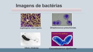 Imagens de bactérias
Leptospira interrogans. Streptococcus pneumoniae.
Vibrio cholerae Corynebacterium diphtheriae
 
