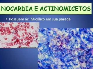 EXISTEM BACTÉRIAS RAMIFICADAS?