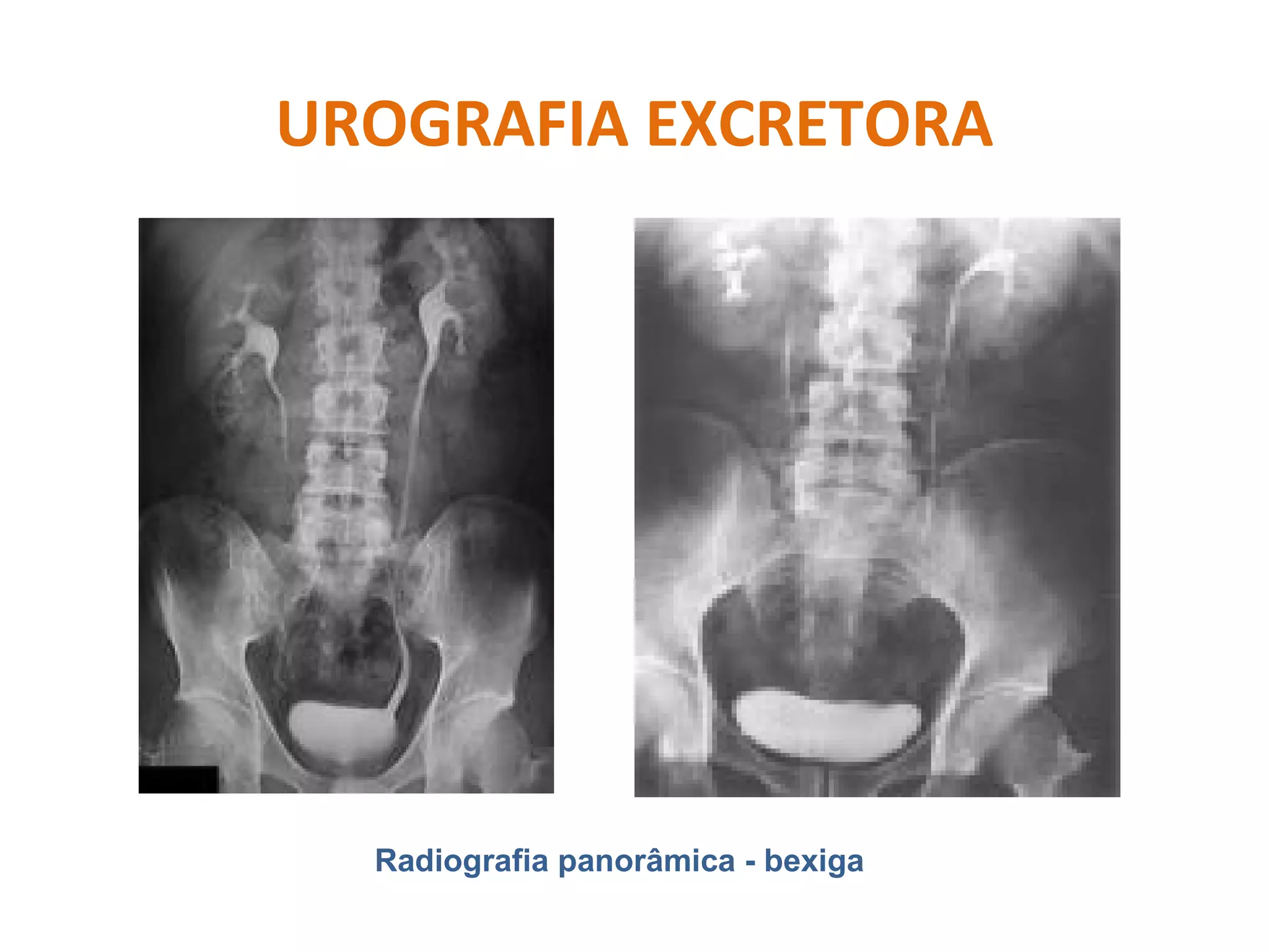 Radiologianota10 Turma 88 - urografia excretora | PPT