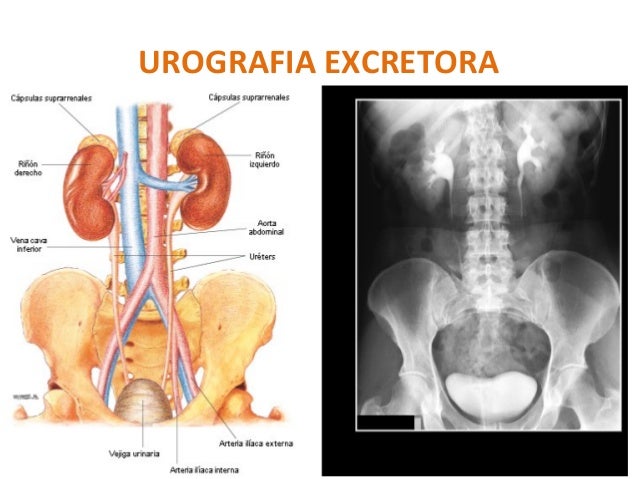 Radiologianota10 Turma 88 - urografia excretora