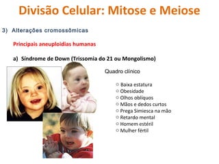 Divisão Celular: Mitose e Meiose 
3) Alterações cromossômicas 
Principais aneuploidias humanas 
a) Síndrome de Down (Triss...