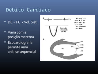 Débito Cardíaco
 DC = FC xVol. Sist.
 Varia com a
posição materna
 Ecocardiografia
permite uma
análise sequencial
 