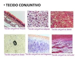 • TECIDO CONJUNTIVO
 