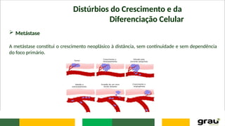 Distúrbios do Crescimento e da
Diferenciação Celular
 Metástase
A metástase constitui o crescimento neoplásico à distância, sem continuidade e sem dependência
do foco primário.
 