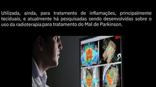 Utilizada, ainda, para tratamento de inflamações, principalmente
teciduais, e atualmente há pesquisadas sendo desenvolvidas sobre o
uso da radioterapiapara tratamento do Mal de Parkinson.
 