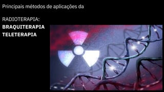 Principais métodos de aplicações da
RADIOTERAPIA:
BRAQUITERAPIA
TELETERAPIA
 