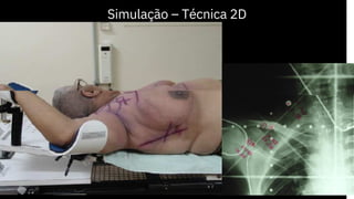 Simulação – Técnica 2D
 