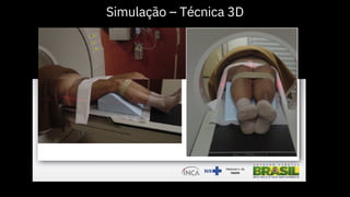 Simulação – Técnica 3D
 