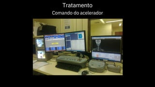 Tratamento
Comando do acelerador
 
