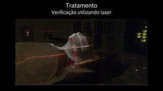 Tratamento
Verificação utilizando laser
 