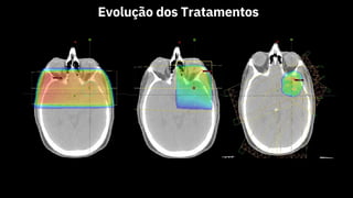 Evolução dos Tratamentos
 