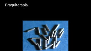 Braquiterapia
 