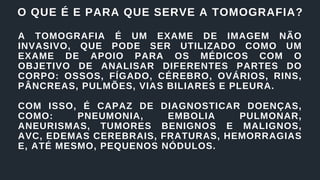 O QUE É E PARA QUE SERVE A TOMOGRAFIA?
A TOMOGRAFIA É UM EXAME DE IMAGEM NÃO
INVASIVO, QUE PODE SER UTILIZADO COMO UM
EXAME DE APOIO PARA OS MÉDICOS COM O
OBJETIVO DE ANALISAR DIFERENTES PARTES DO
CORPO: OSSOS, FÍGADO, CÉREBRO, OVÁRIOS, RINS,
PÂNCREAS, PULMÕES, VIAS BILIARES E PLEURA.
COM ISSO, É CAPAZ DE DIAGNOSTICAR DOENÇAS,
COMO: PNEUMONIA, EMBOLIA PULMONAR,
ANEURISMAS, TUMORES BENIGNOS E MALIGNOS,
AVC, EDEMAS CEREBRAIS, FRATURAS, HEMORRAGIAS
E, ATÉ MESMO, PEQUENOS NÓDULOS.
 