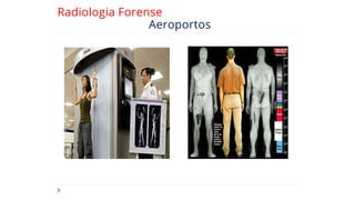 Radiologia Forense
Aeroportos
 