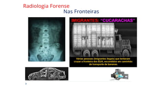 Radiologia Forense
Nas Fronteiras
 