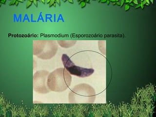 MALÁRIA
Protozoário: Plasmodium (Esporozoário parasita).
 