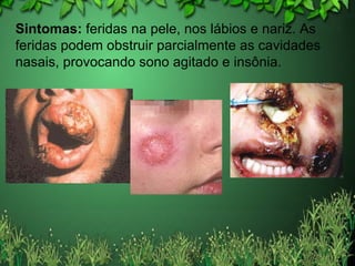 Sintomas:  feridas na pele, nos lábios e nariz. As feridas podem obstruir parcialmente as cavidades nasais, provocando sono agitado e insônia. 