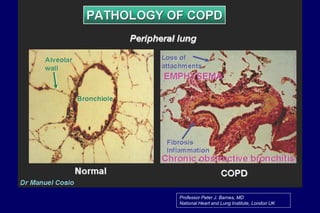 Professor Peter J. Barnes, MD
National Heart and Lung Institute, London UK
 