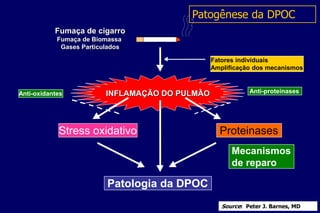 INFLAMAÇÃO DO PULMÃO
Fatores individuais
Amplificação dos mecanismos
Patologia da DPOC
ProteinasesStress oxidativo
Anti-proteinasesAnti-oxidantes
Mecanismos
de reparo
Fumaça de cigarro
Fumaça de Biomassa
Gases Particulados
Patogênese da DPOC
Source: Peter J. Barnes, MD
 
