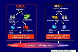 Mastócitos
CD4+ cell
(Th2)
Eosinófilos
Alérgenos
Células
epitélio
ASMA
Broncoconstrição
Hiperresponsividade
Alv macrófago Ep cells
CD8+ cell
(Tc1)
Neutrófilos
Fumaça de cigarro
Redução calibre pequenas
vias e Destruição alveolar
DPOC
Reversível IrreversívelLimitação do fluxo aéreo
Source: Peter J. Barnes, MD
 