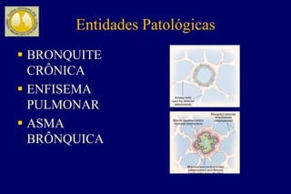 Entidades Patológicas
 BRONQUITE
CRÔNICA
 ENFISEMA
PULMONAR
 ASMA
BRÔNQUICA
 