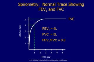 Spirometry: Normal Trace Showing
FEV1 and FVC
1 2 3 4 5 6
1
2
3
4
Volume,liters
Time, sec
FVC5
1
FEV1 = 4L
FVC = 5L
FEV1/FVC = 0.8
© 2014 Global Initiative for Chronic Obstructive Lung Disease
 