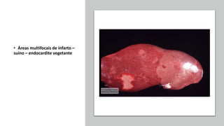 • Áreas multifocais de infarto –
suíno – endocardite vegetante
 
