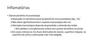 Inflamatórias
• Glomerulonefrite imunomediada
Deposição na membrana basal do glomérulo imunocomplexos (Ag – Ac)
Não altera significativamente o aspecto macroscópico dos rins
Alteração macroscópica depende da gravidade e extensão das lesões
oRins pálidos e com glómerulos visíveis com pontos vermelhos no córtex
Em casos crônicos os rins ficam diminuídos de volume, superfície irregular, na
superfície de corte o córtex pode estar mais delgado
 