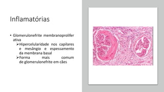 Inflamatórias
• Glomerulonefrite membranoprolifer
ativa
Hipercelularidade nos capilares
e mesângio e espessamento
da membrana basal
Forma mais comum
de glomerulonefrite em cães
 