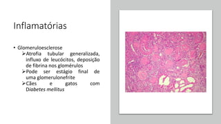 Inflamatórias
• Glomeruloesclerose
Atrofia tubular generalizada,
influxo de leucócitos, deposição
de fibrina nos glomérulos
Pode ser estágio final de
uma glomerulonefrite
Cães e gatos com
Diabetes mellitus
 