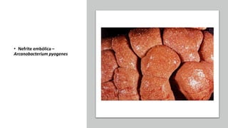 • Nefrite embólica –
Arcanobacterium pyogenes
 