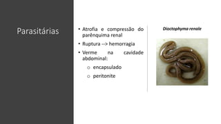 Parasitárias • Atrofia e compressão do
parênquima renal
• Ruptura --> hemorragia
• Verme na cavidade
abdominal:
o encapsulado
o peritonite
Dioctophyma renale
 