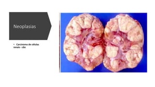 Neoplasias
• Carcinoma de células
renais - cão
 