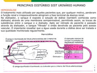 HEMODIÁLISE
O tratamento mais utilizado por aqueles pacientes que, por qualquer motivo, perderam
a função renal e irreparavelmente atingiram a fase terminal da doença renal.
No dialisador, o sangue é exposto à solução de diálise (também conhecida como
dialisato) através de uma membrana semipermeável, permitindo assim, as trocas de
substâncias entre o sangue e o dialisato. Após ser retirado do paciente e passado
através do dialisador, o sangue “filtrado” é então devolvido ao paciente pelo acesso
vascular. É importante ressaltar que a água usada durante a diálise deve ser tratada e
sua qualidade monitorada regularmente.
PRINCIPAIS DISTÚRBIO SIST URINÁRIO HUMANO
 