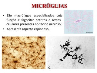 MICRÓGLIAS
• São macrófagos especializados cuja
função é fagocitar detritos e restos
celulares presentes no tecido nervoso;
• Apresenta aspecto espinhoso.
 